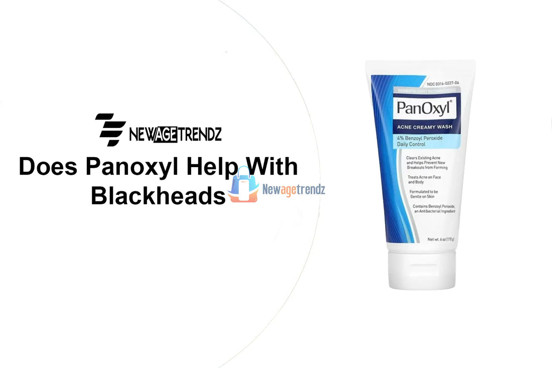 Does Panoxyl Help With Blackheads